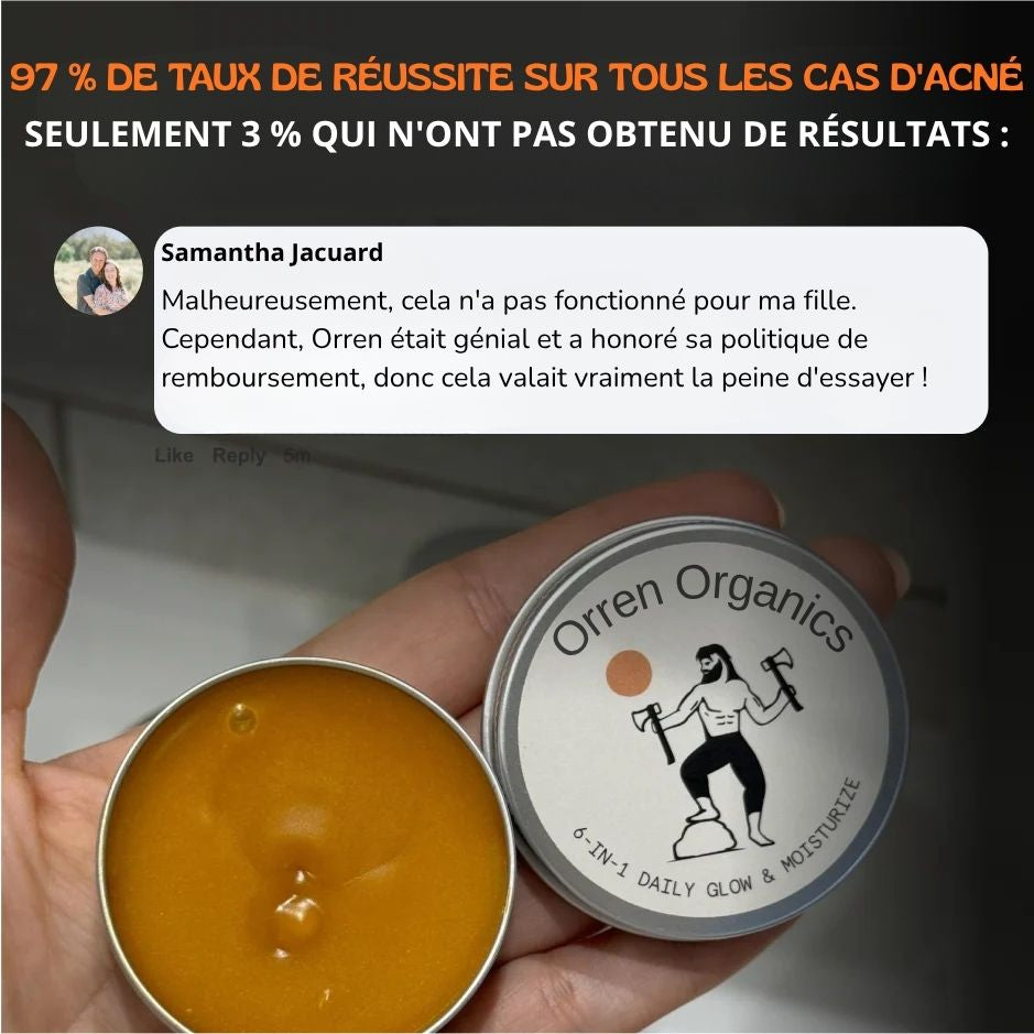 soin peau acné homme femme,