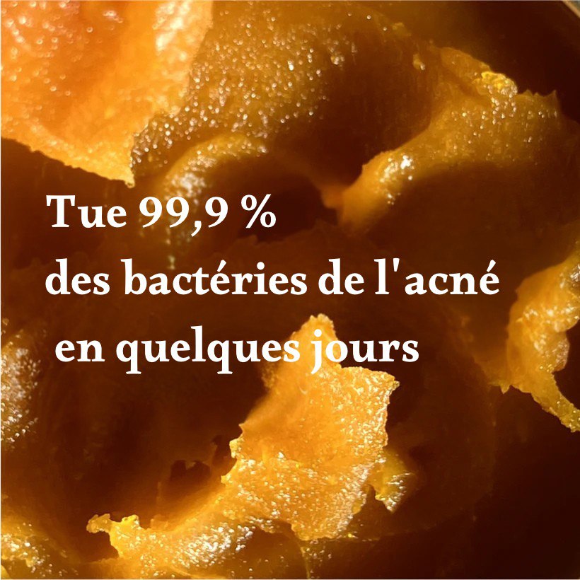 tueur d'acné